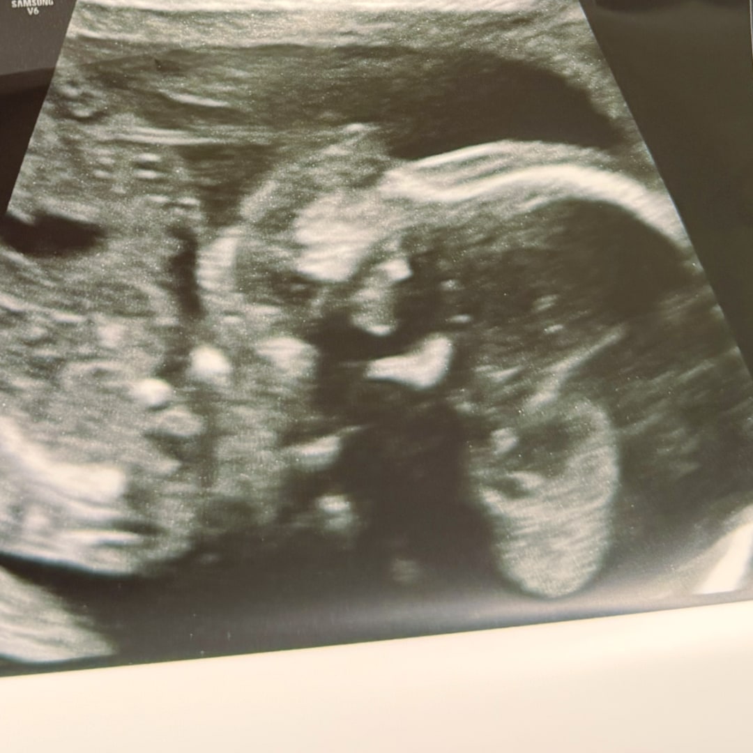 Photo shared by Gisselle for their Babylist baby registry.