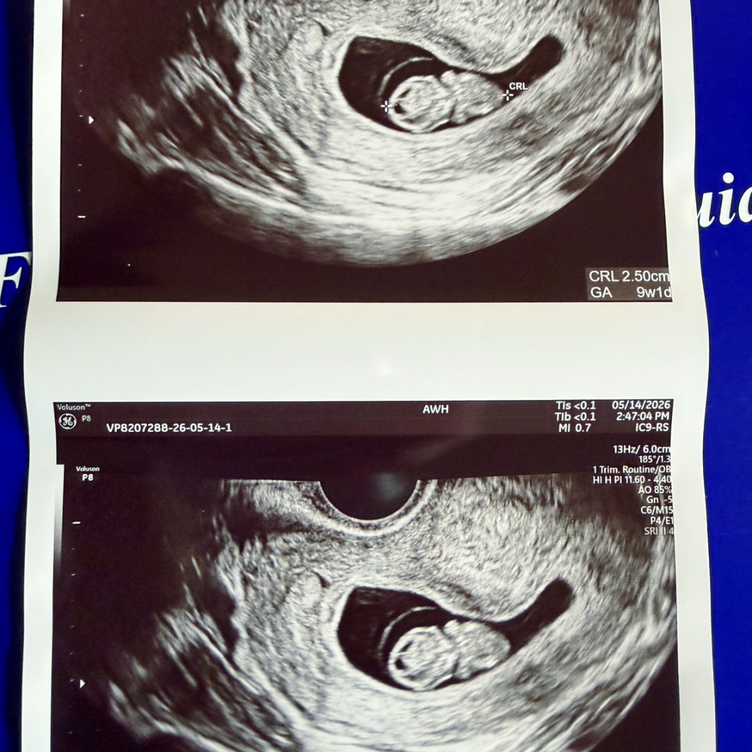 Photo shared by Hannah for their Babylist baby registry.