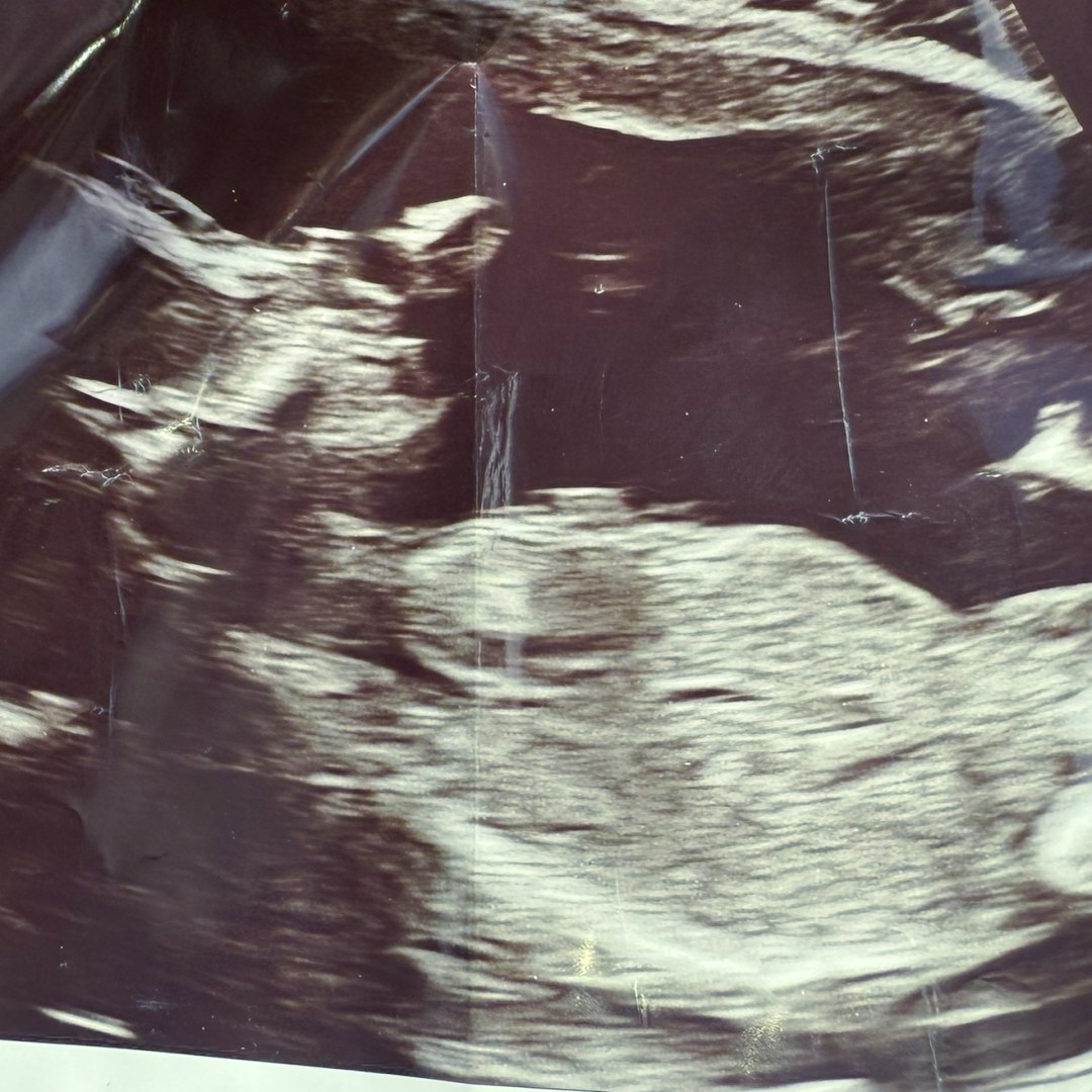 Photo shared by Trinity for their Babylist baby registry.