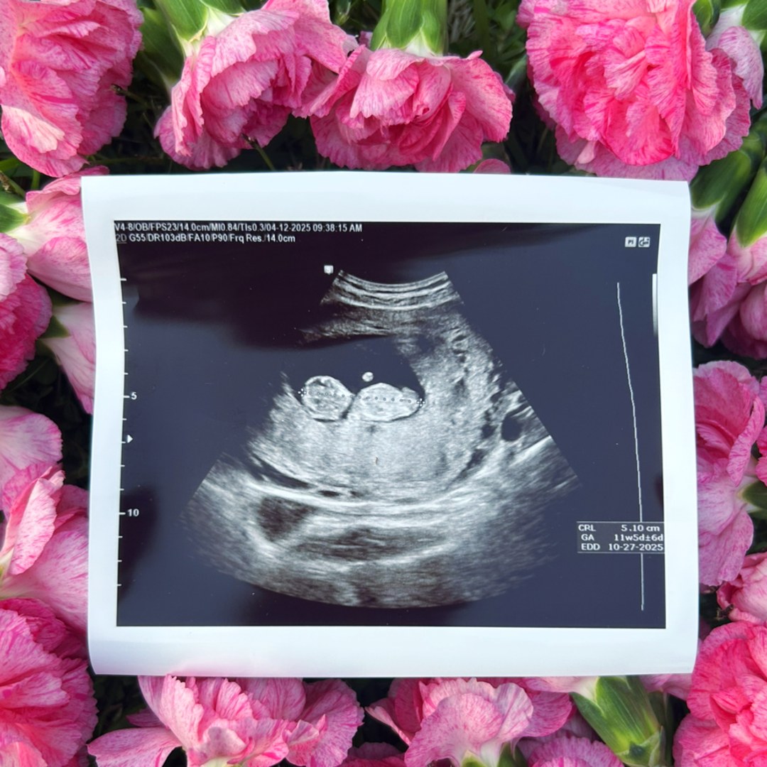 Photo shared by Abigail for their Babylist baby registry.