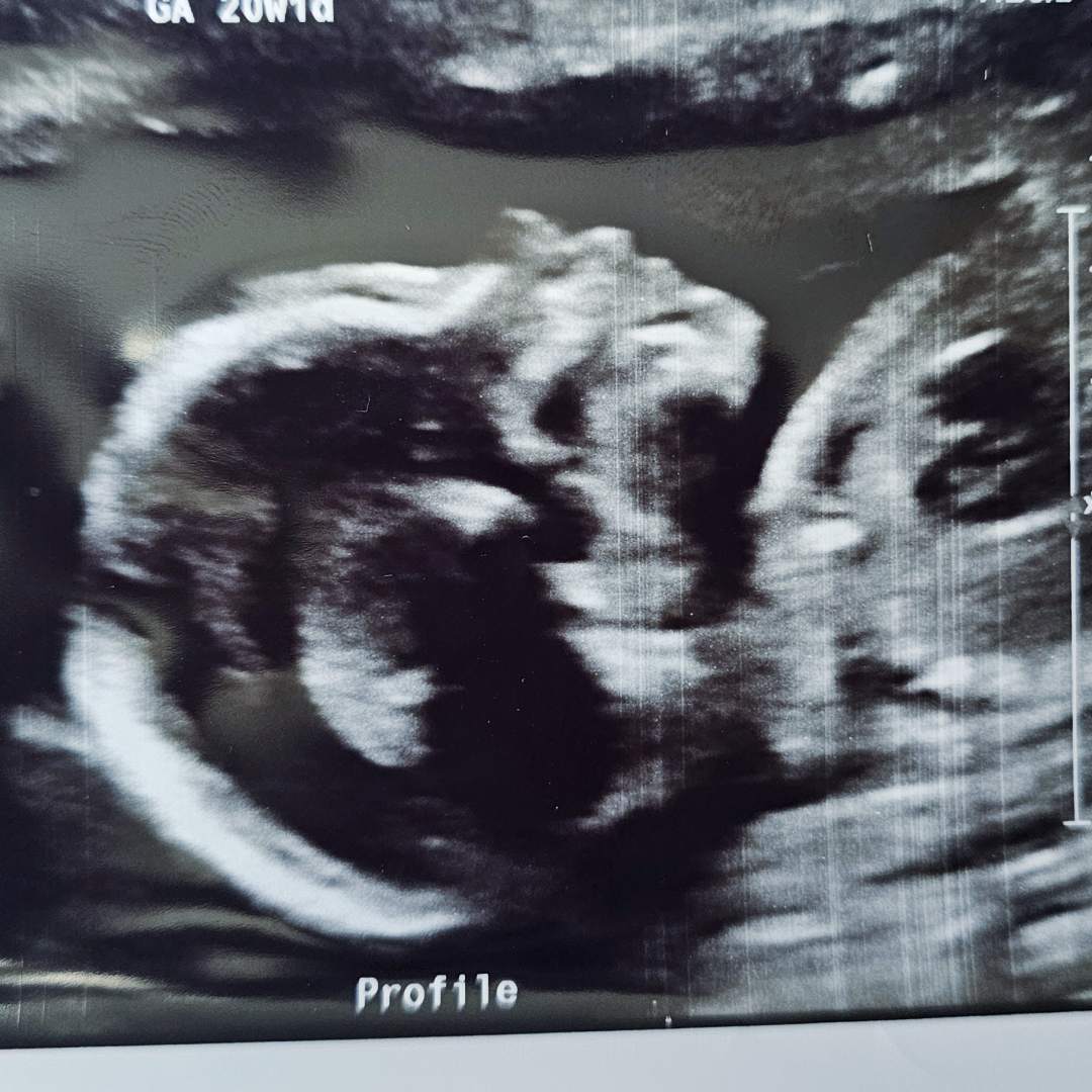 Photo shared by Brenda for their Babylist baby registry.