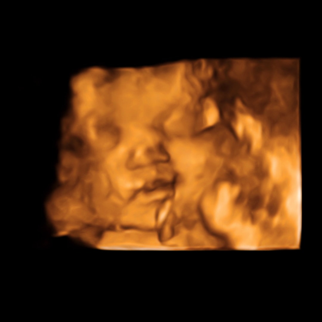 Photo shared by Mariah for their Babylist baby registry.