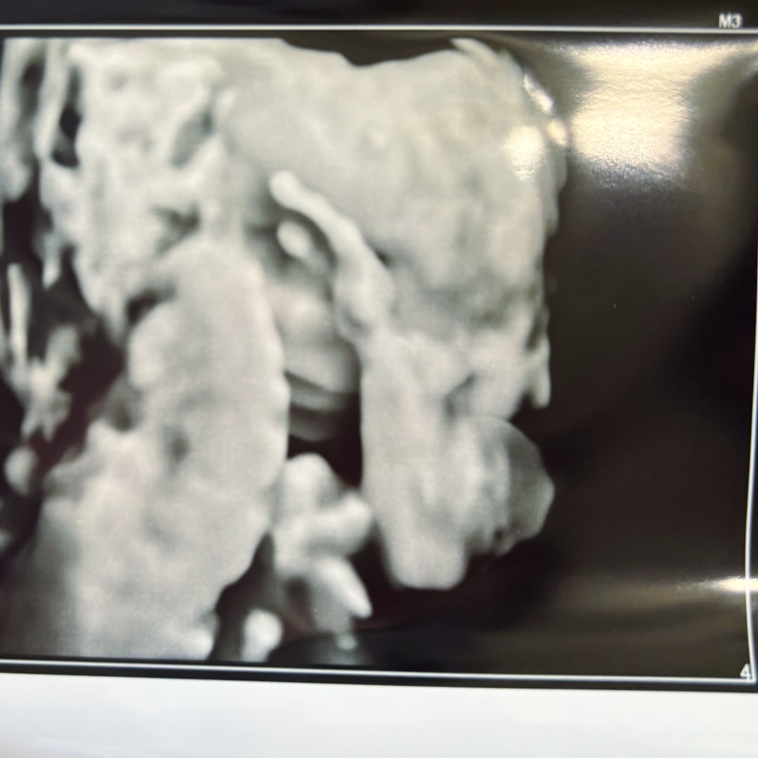 Photo shared by Charlotte for their Babylist baby registry.