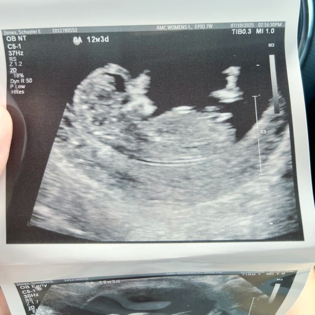 Photo shared by Schuyler for their Babylist baby registry.