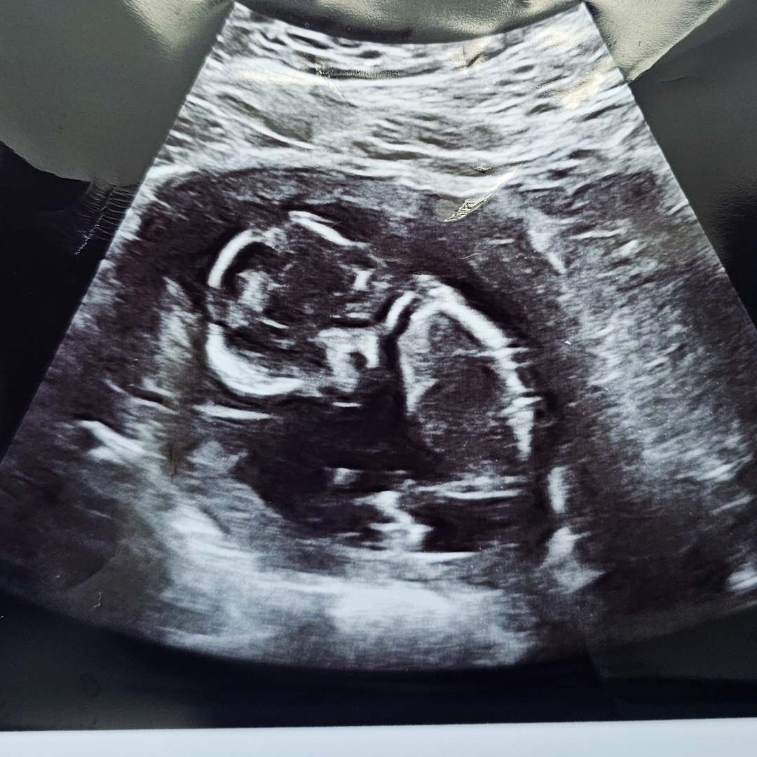 Photo shared by Brenda for their Babylist baby registry.
