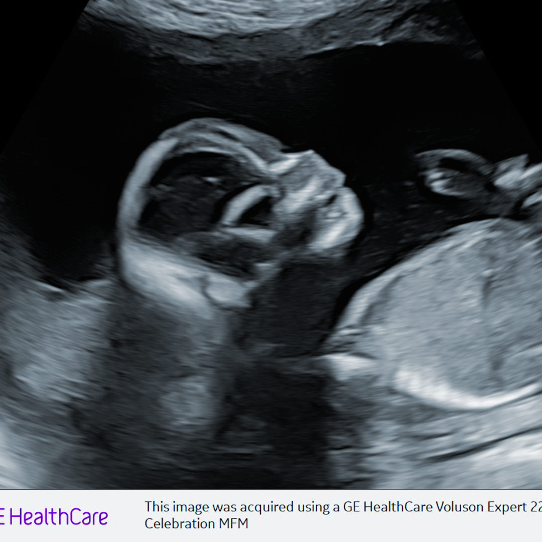 Photo shared by Hannah for their Babylist baby registry.