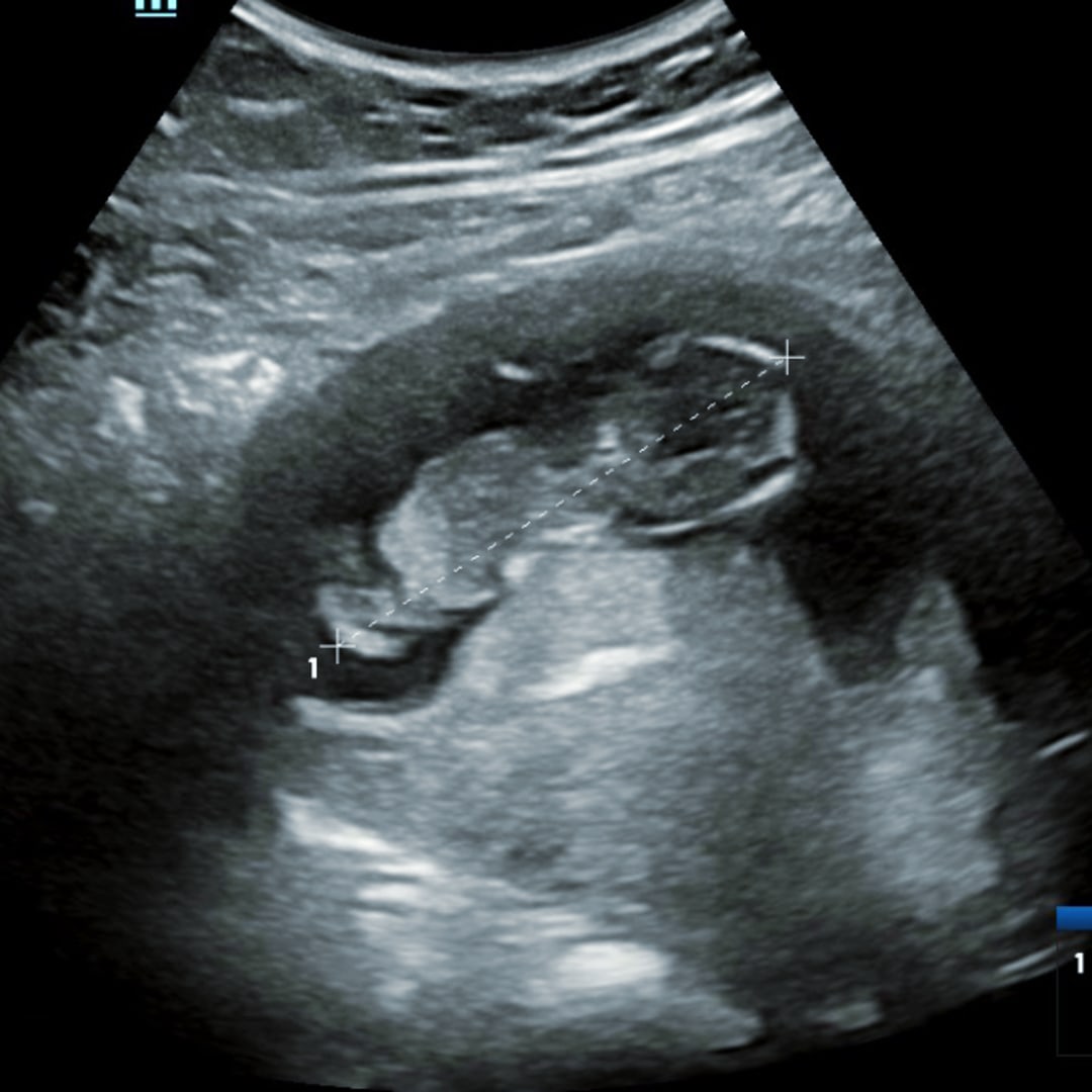 Photo shared by Allison for their Babylist baby registry.