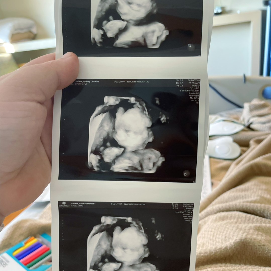 Photo shared by Sydney for their Babylist baby registry.