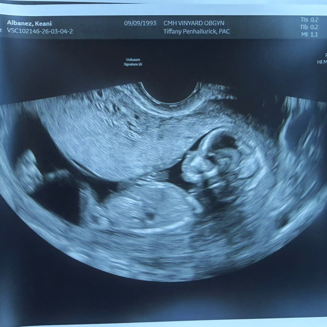 Photo shared by Keani for their Babylist baby registry.