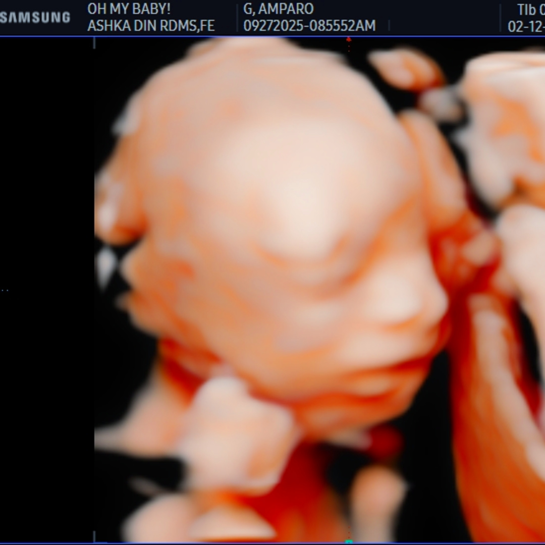 Photo shared by Amparo for their Babylist baby registry.