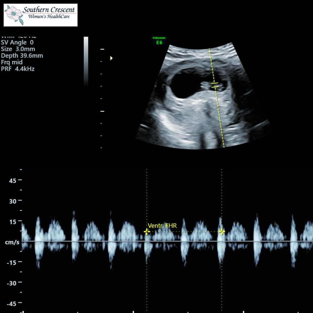 Photo shared by Jennie for their Babylist baby registry.