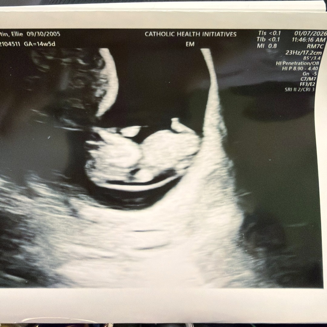 Photo shared by Ellie for their Babylist baby registry.