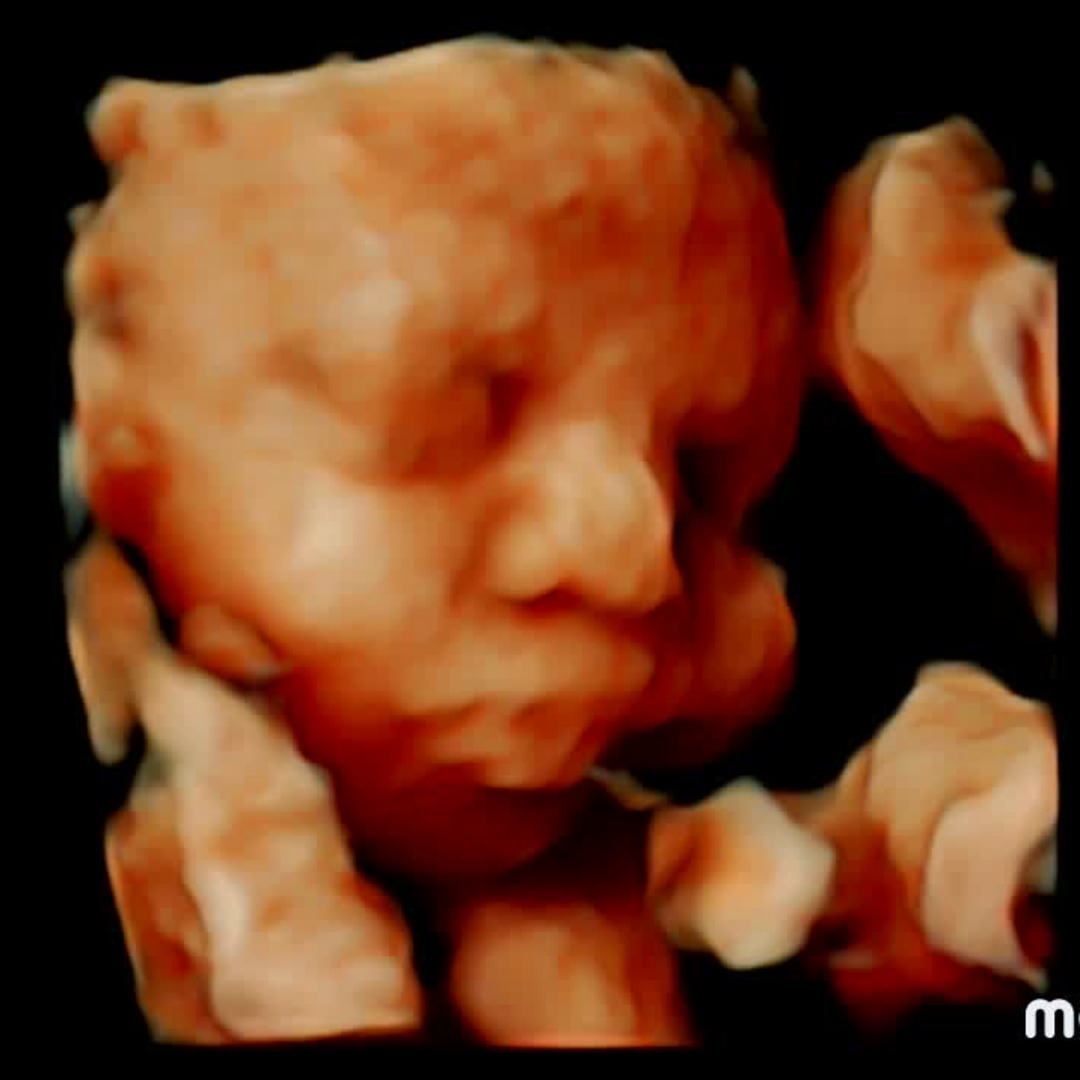 Photo shared by Carolina for their Babylist baby registry.