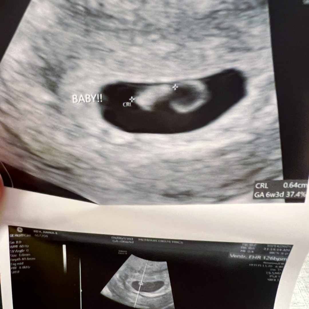 Photo shared by Anna for their Babylist baby registry.