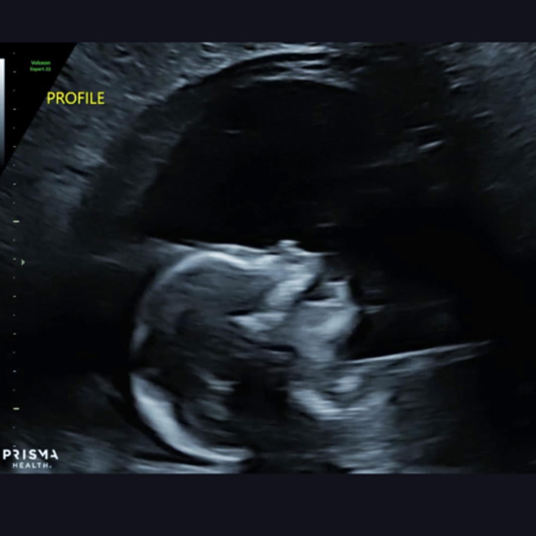 Photo shared by Lillie for their Babylist baby registry.