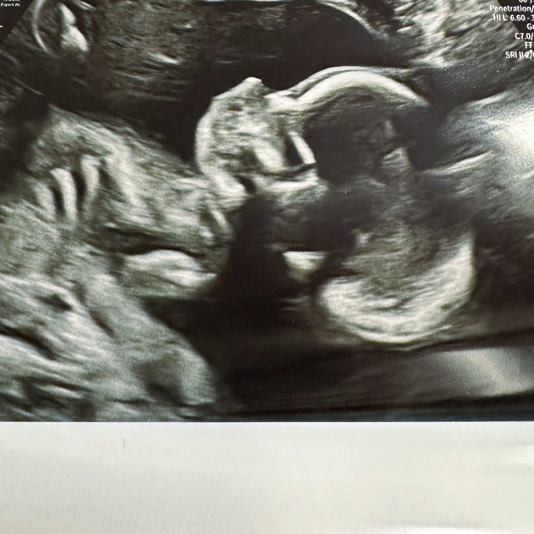 Photo shared by Ashtyn for their Babylist baby registry.