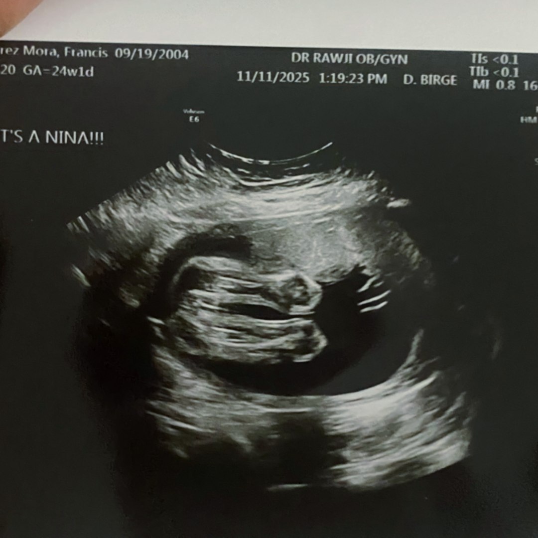 Photo shared by Betzabe for their Babylist baby registry.