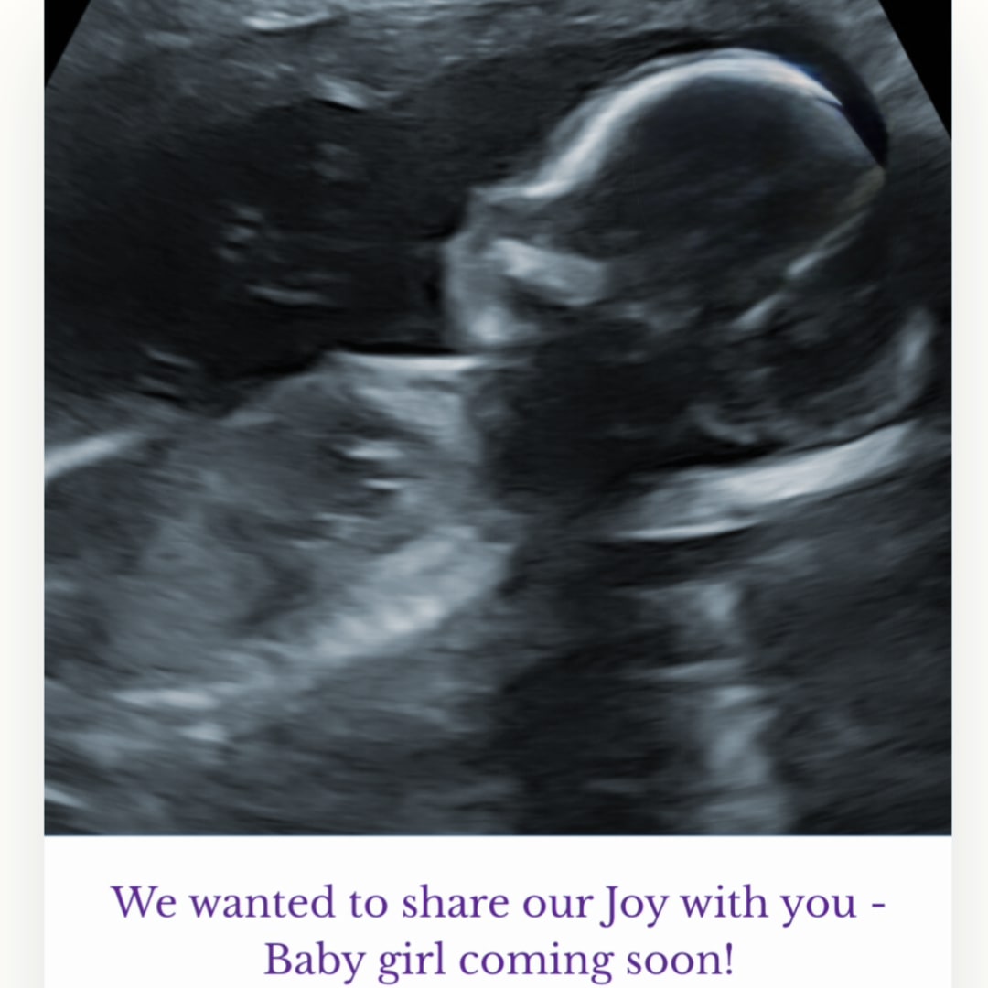 Photo shared by Chelsea for their Babylist baby registry.