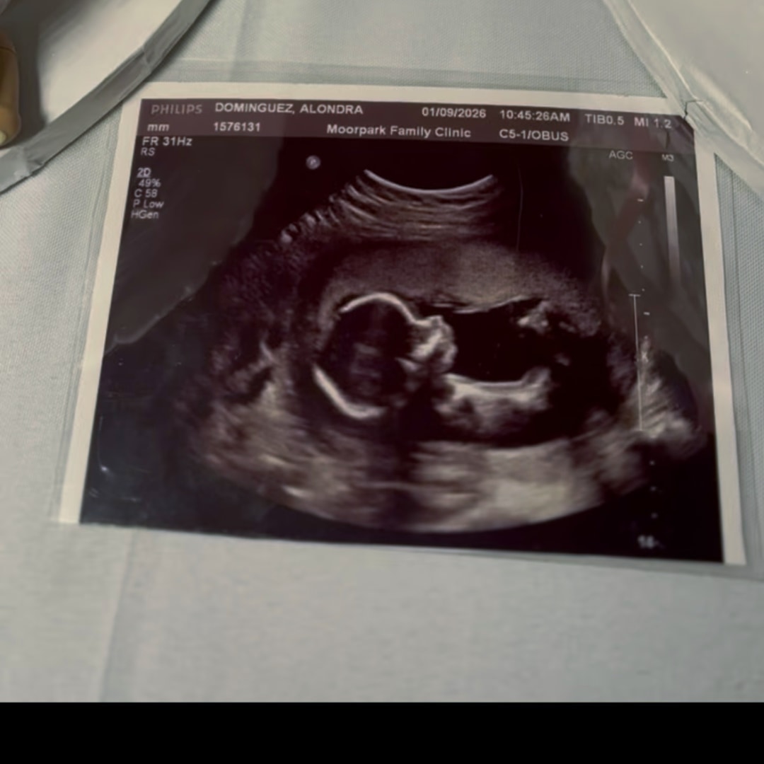 Photo shared by Alondra for their Babylist baby registry.