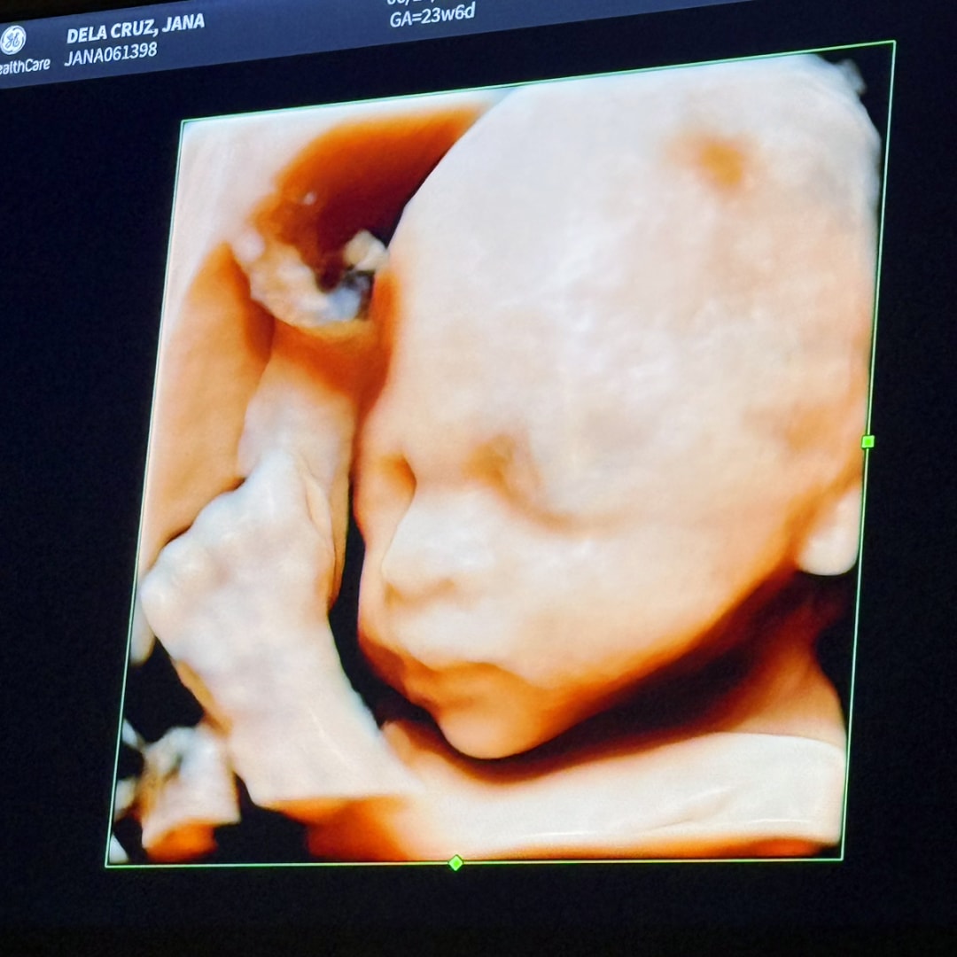Photo shared by Jana for their Babylist baby registry.