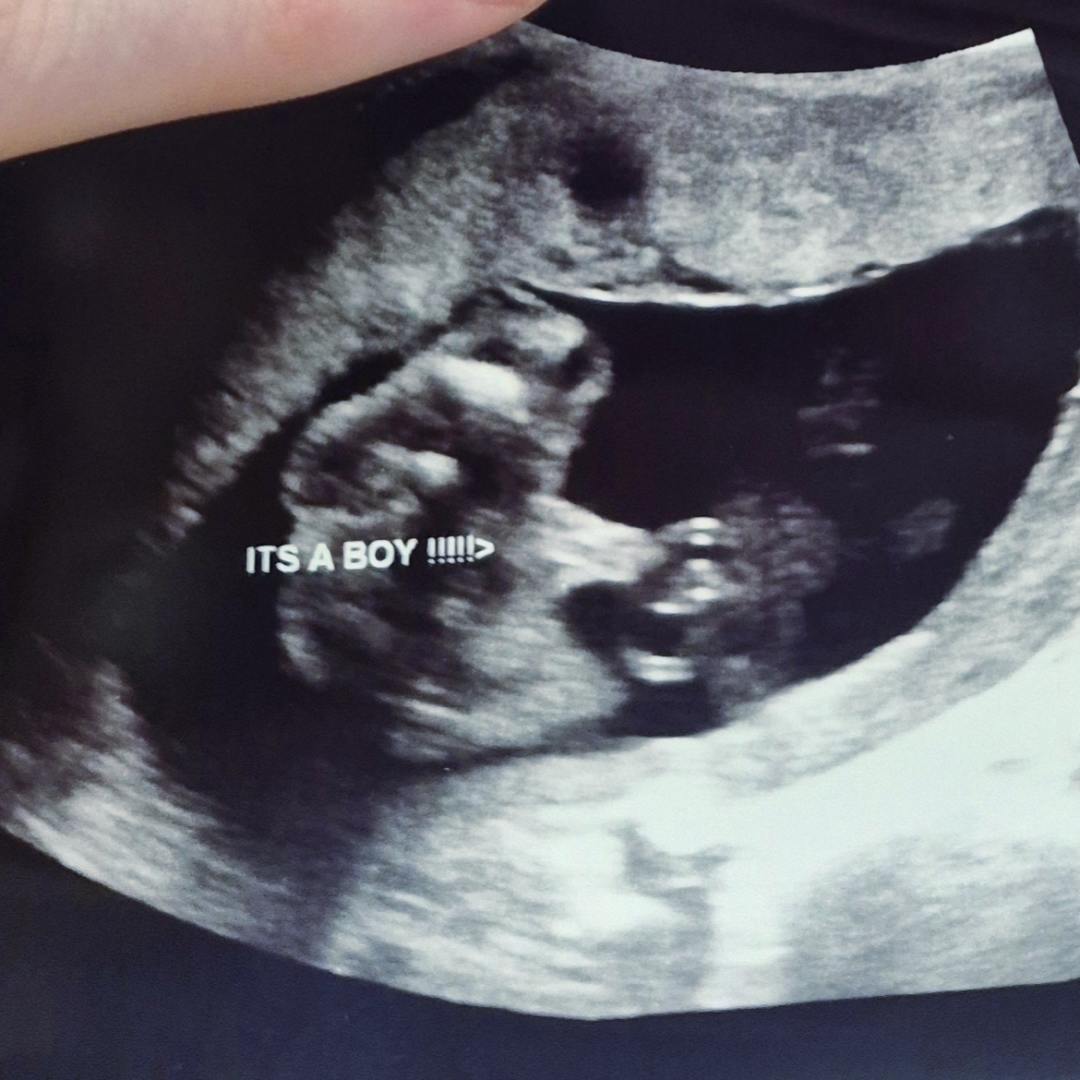 Photo shared by Madison for their Babylist baby registry.