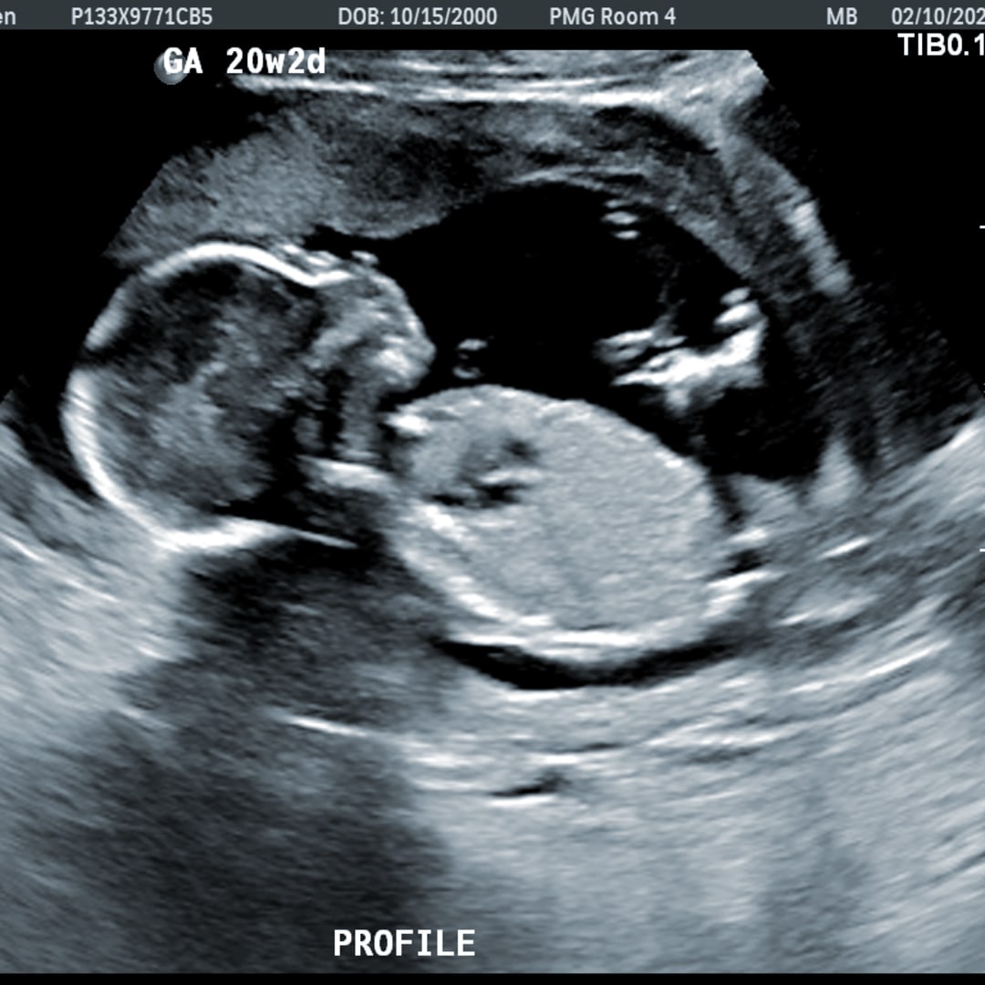 Photo shared by Christopher for their Babylist baby registry.