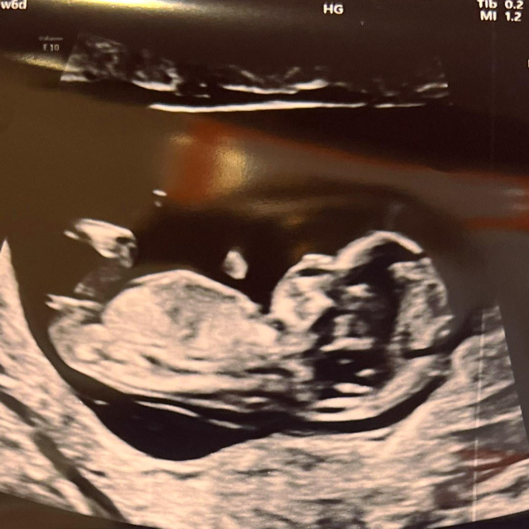 Photo shared by Shayla for their Babylist baby registry.