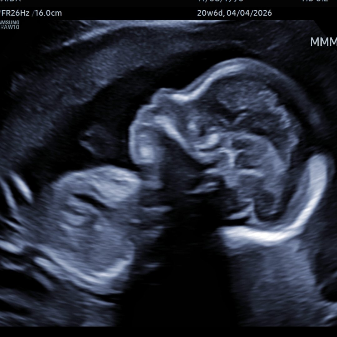 Photo shared by Naida for their Babylist baby registry.