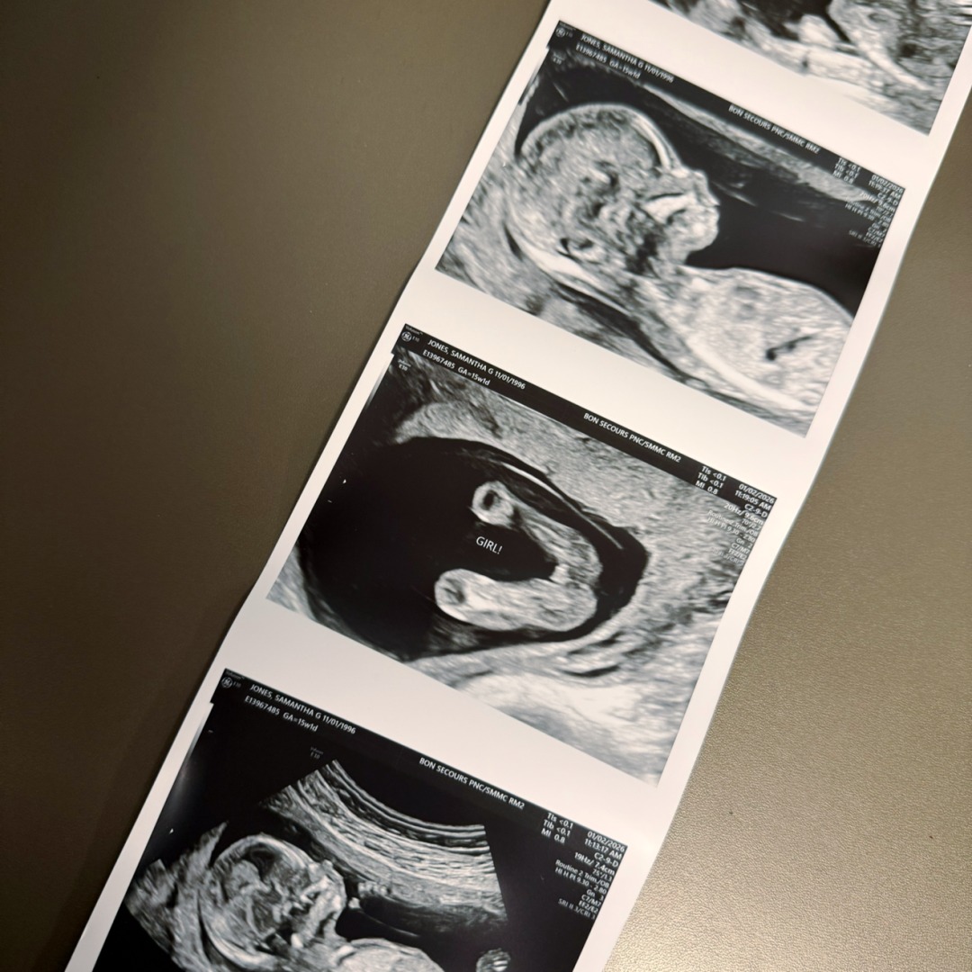 Photo shared by Samantha for their Babylist baby registry.