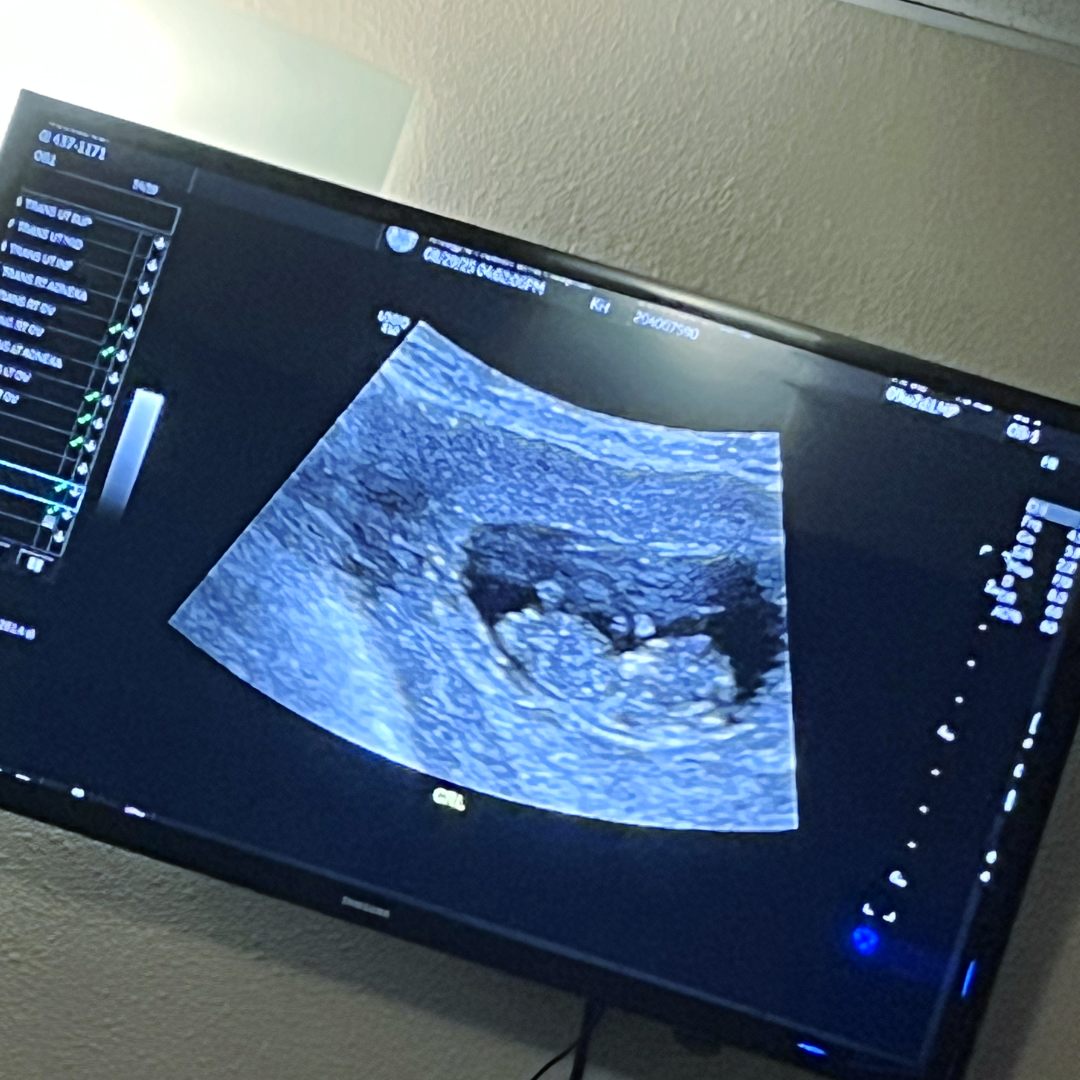 Photo shared by Alexis for their Babylist baby registry.