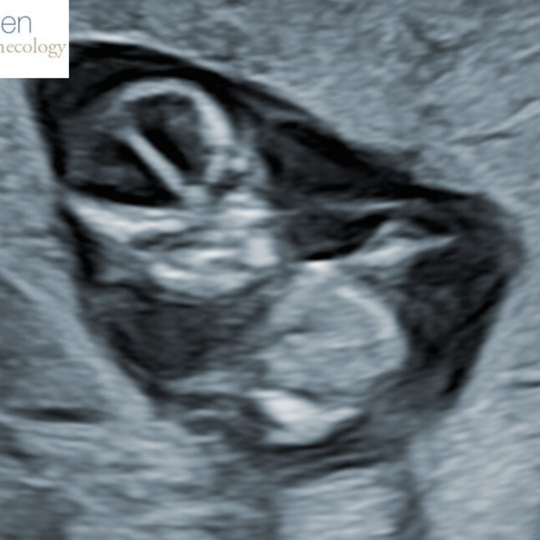Photo shared by Arianna for their Babylist baby registry.