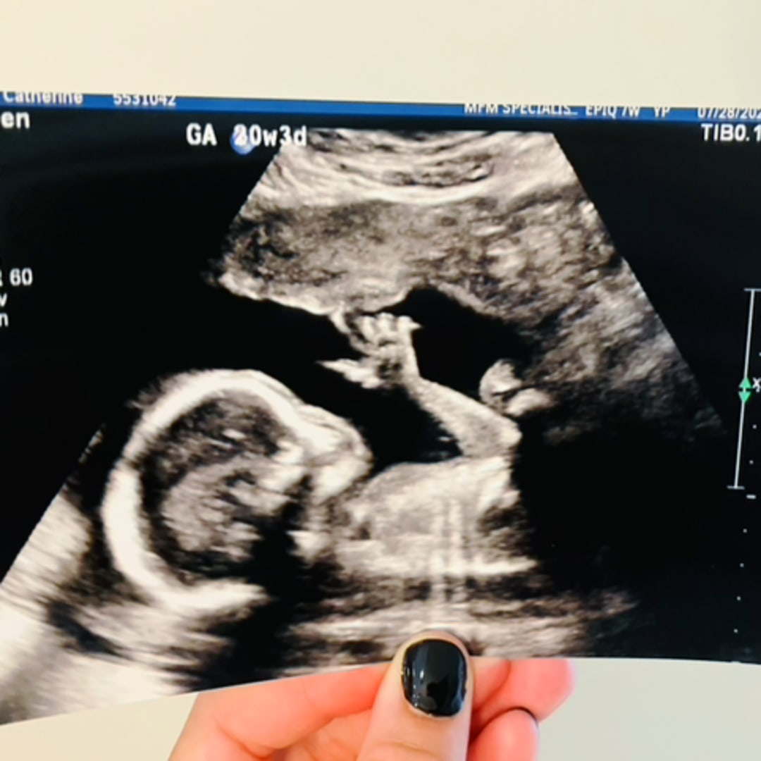 Photo shared by Catherine for their Babylist baby registry.