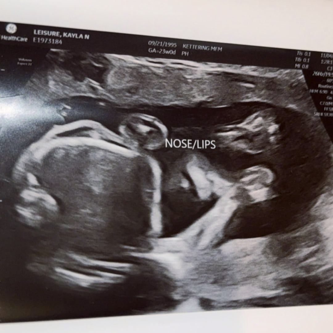 Photo shared by Kayla for their Babylist baby registry.