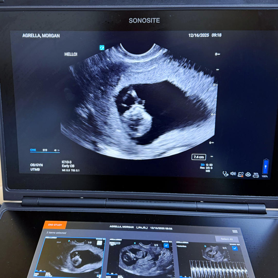 Photo shared by Morgan for their Babylist baby registry.