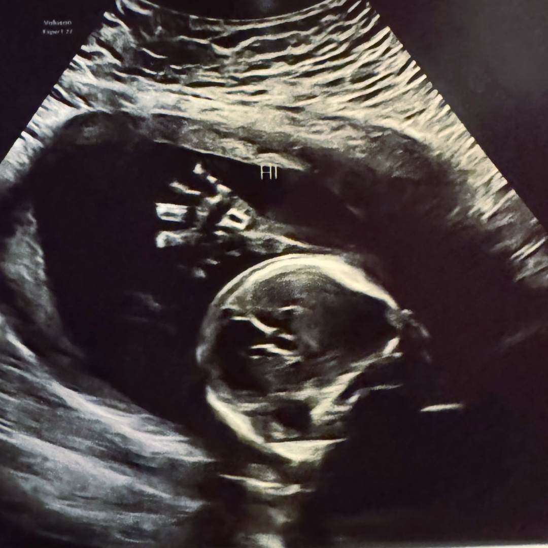 Photo shared by Hayley for their Babylist baby registry.