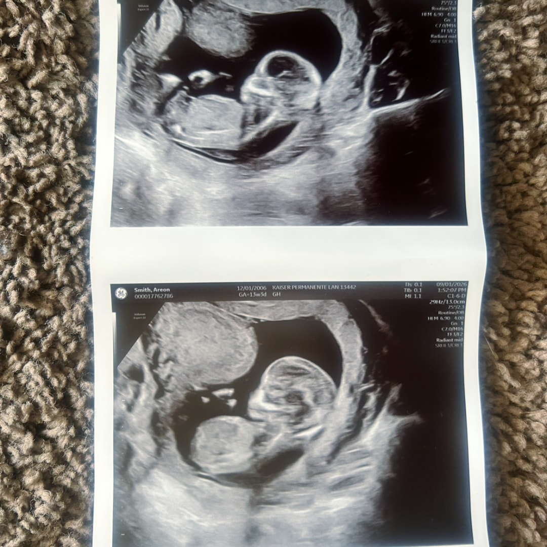 Photo shared by Exavier for their Babylist baby registry.