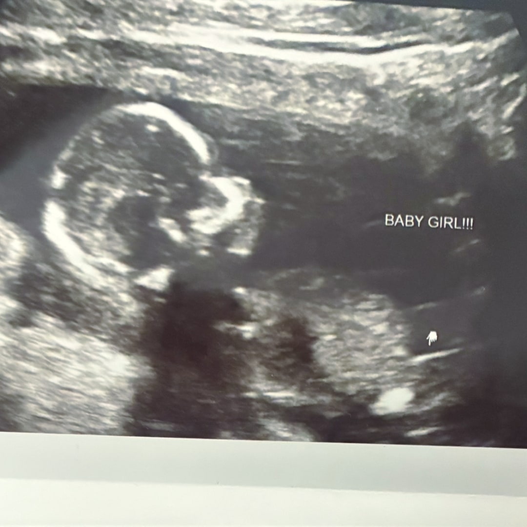 Photo shared by Loraine for their Babylist baby registry.