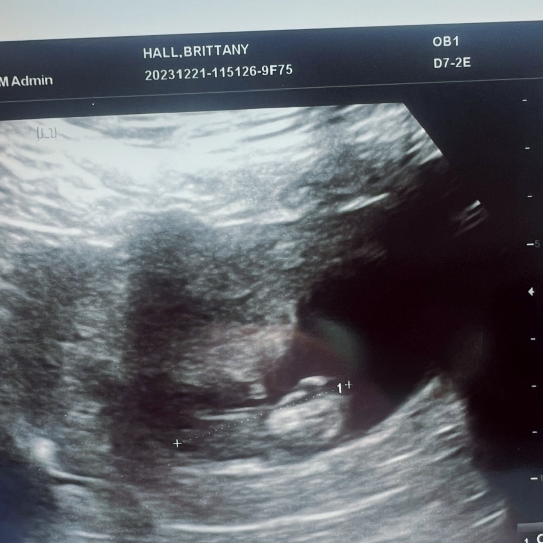 Photo shared by Brittany for their Babylist baby registry.