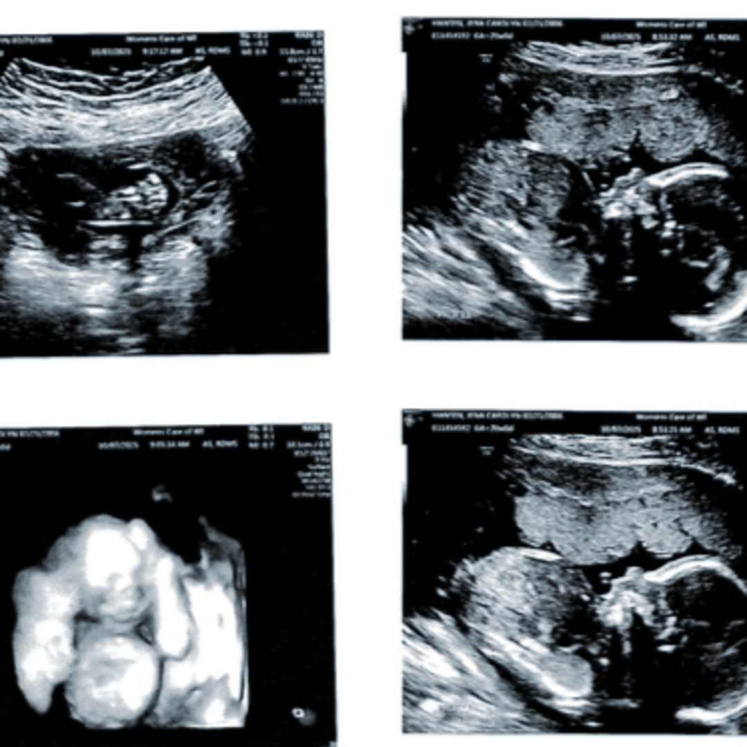 Photo shared by Jena for their Babylist baby registry.