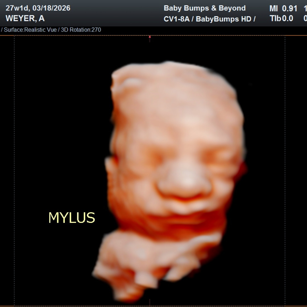 Photo shared by Alexis for their Babylist baby registry.