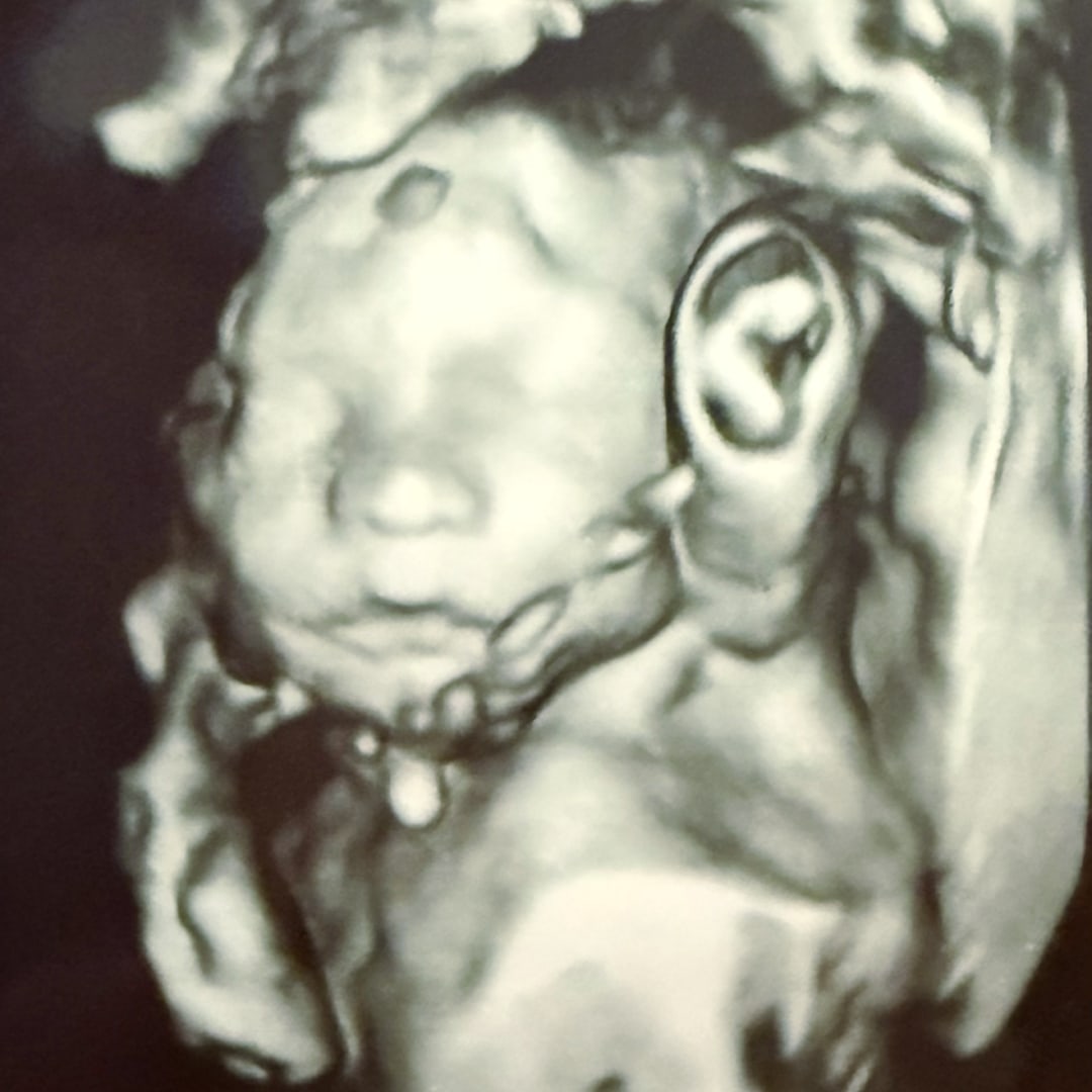 Photo shared by Cheyanne for their Babylist baby registry.