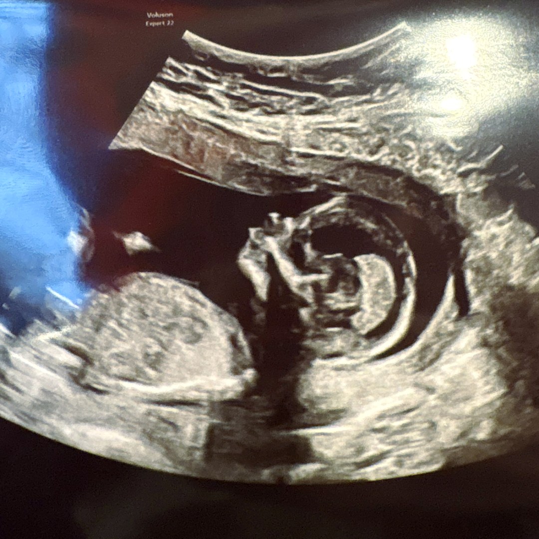 Photo shared by Sarah for their Babylist baby registry.