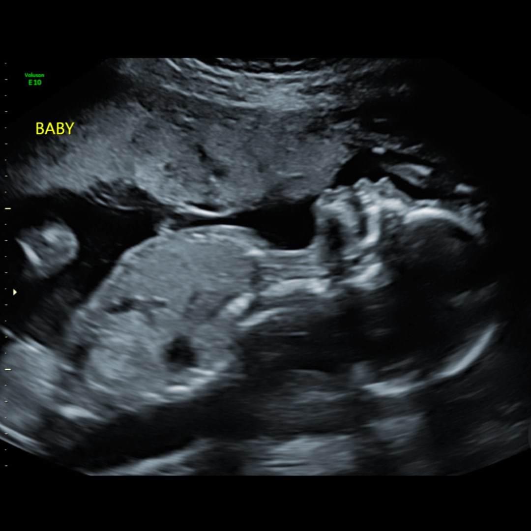 Photo shared by Gavin for their Babylist baby registry.