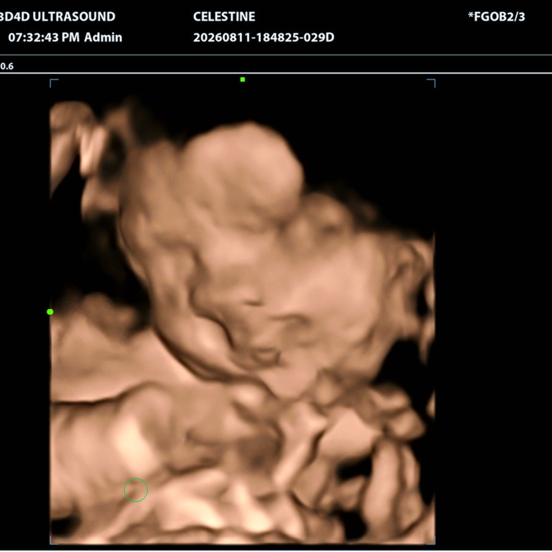 Photo shared by Celeste for their Babylist baby registry.