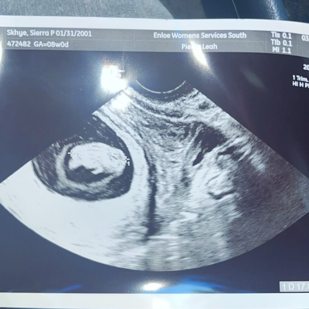 Photo shared by Sierra for their Babylist baby registry.