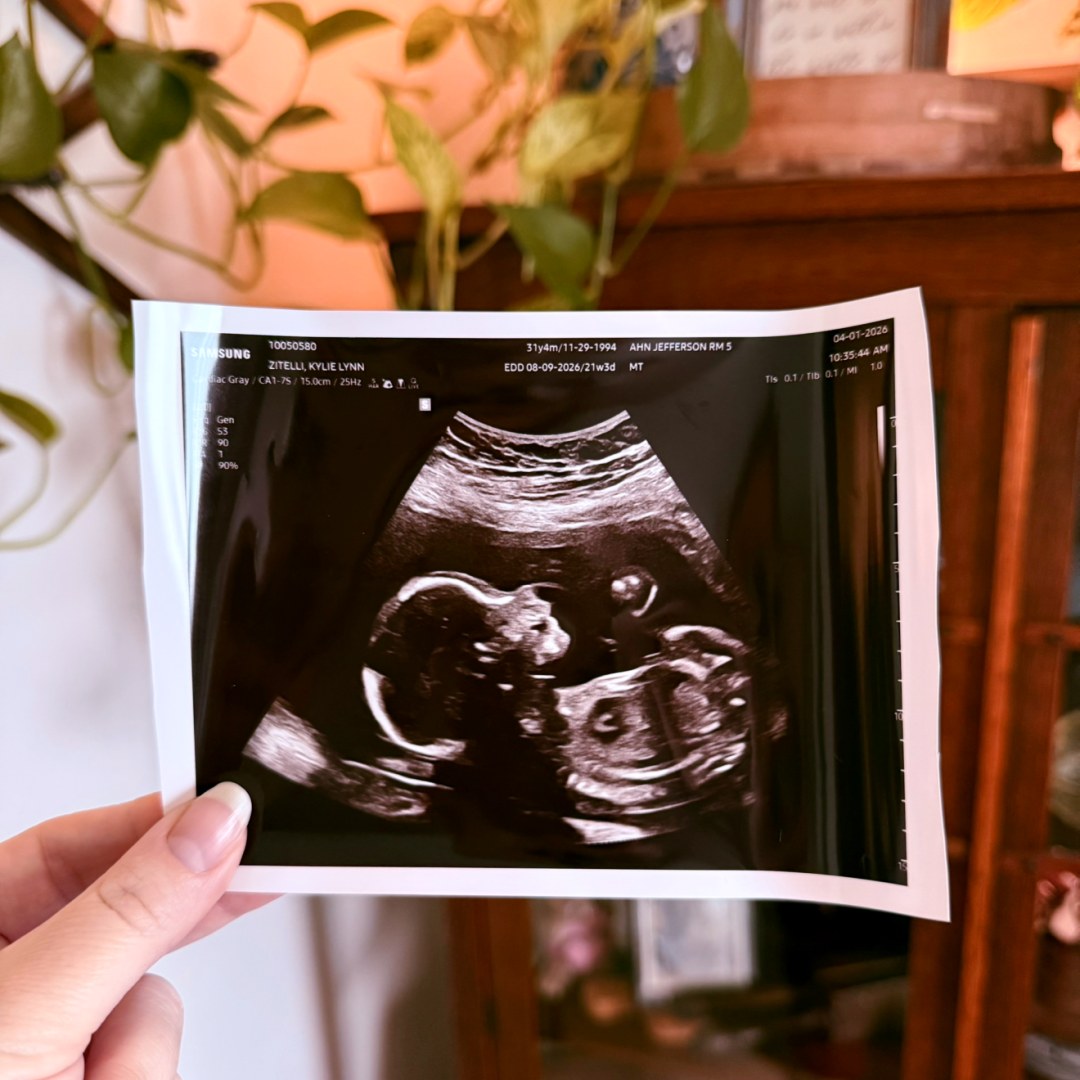 Photo shared by Kylie for their Babylist baby registry.