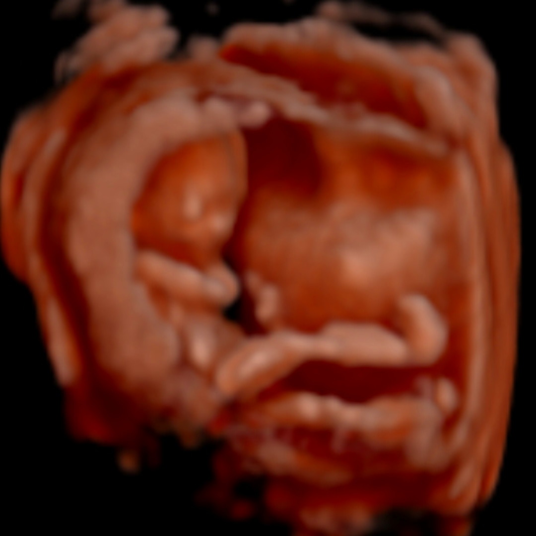 Photo shared by Jackie for their Babylist baby registry.