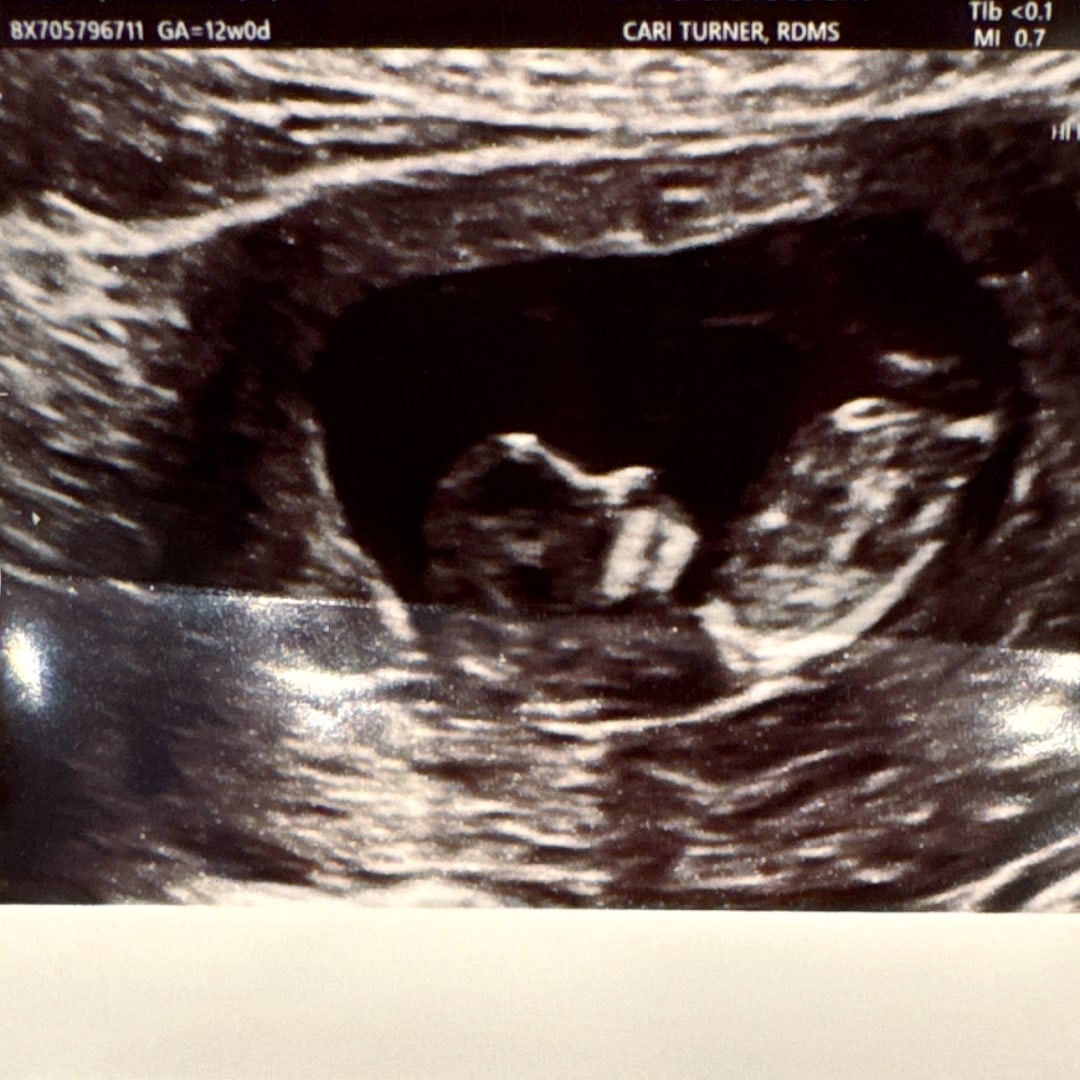 Photo shared by Fiorela for their Babylist baby registry.