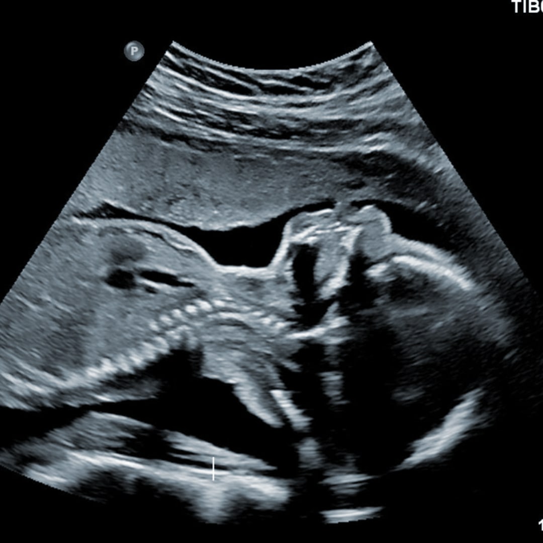 Photo shared by Cylie for their Babylist baby registry.