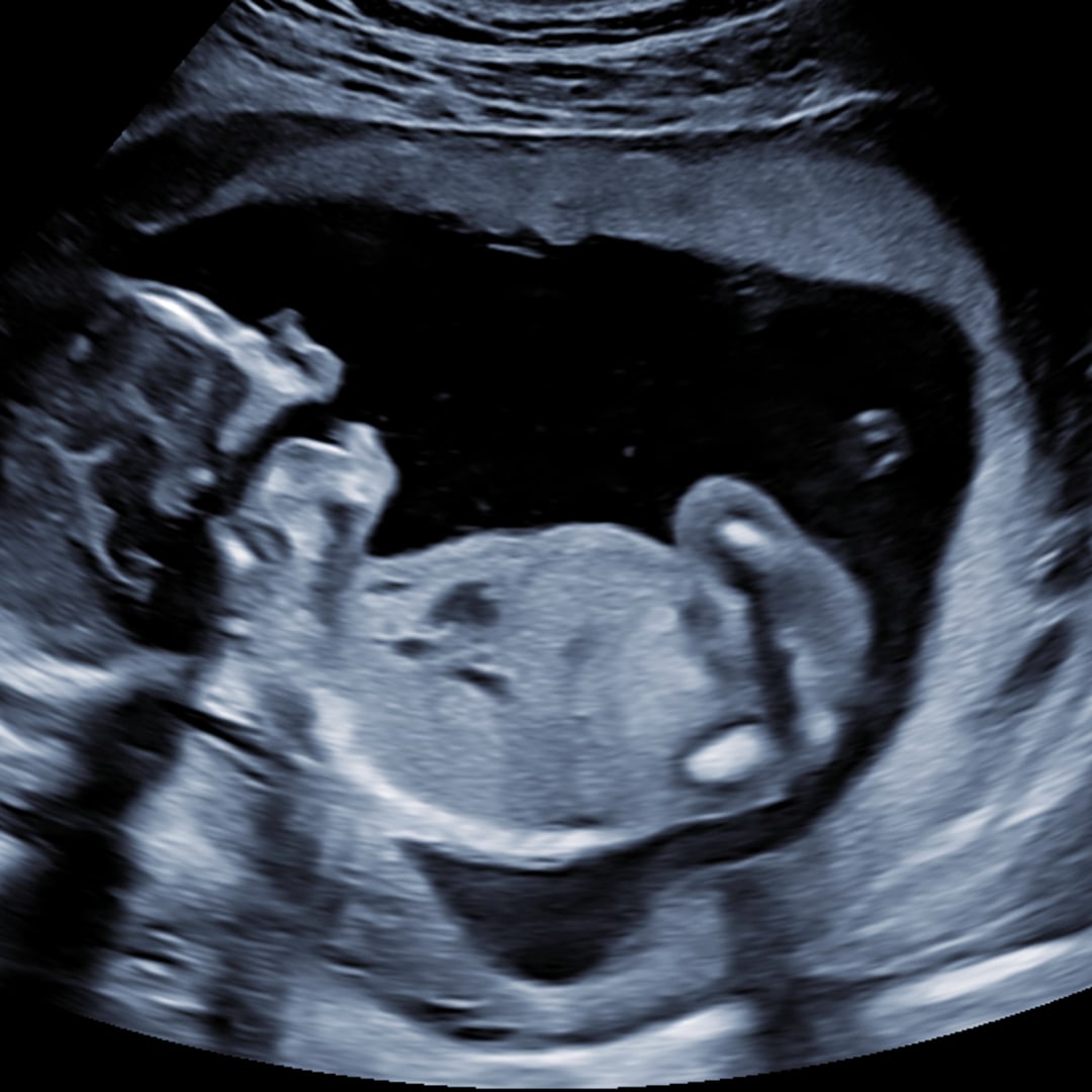 Photo shared by Jordan for their Babylist baby registry.